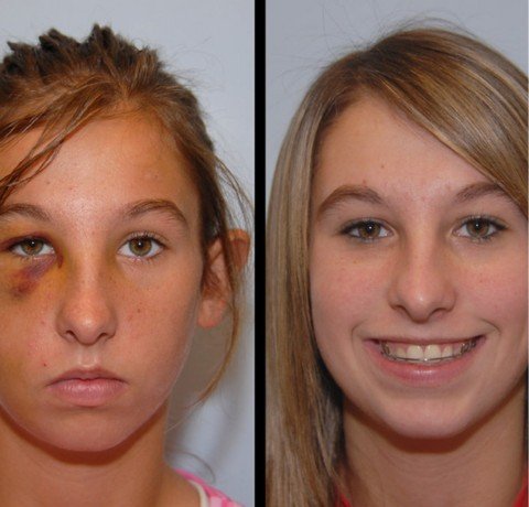 Facial Trauma Surgeries at Garg dental & Aesthetic Clinic Gorakhpur