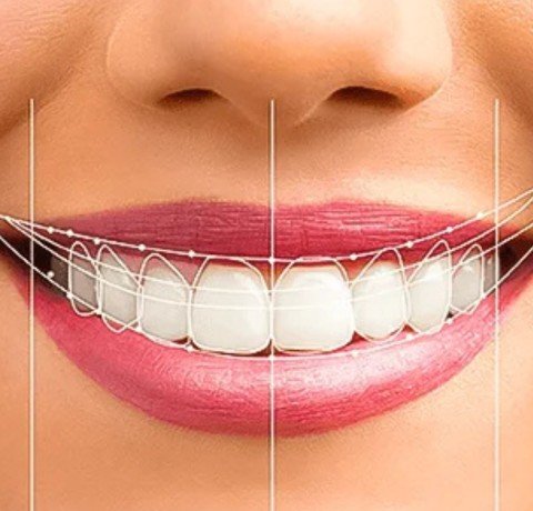 Smile Designing at Garg dental & Aesthetic Clinic Gorakhpur