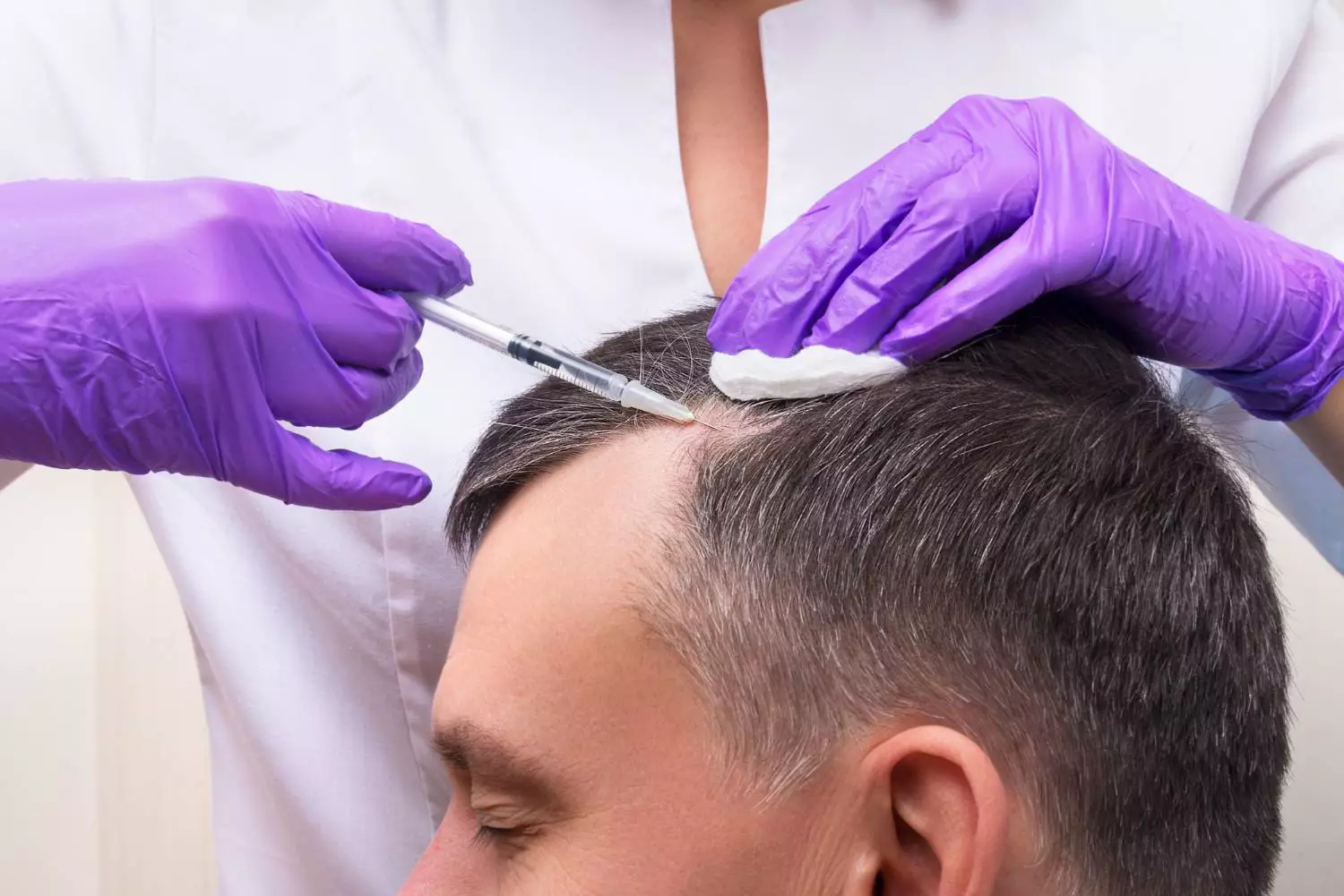 Hair Treatment in gorakhpir at Garg Dental & Aesthetic Clinic